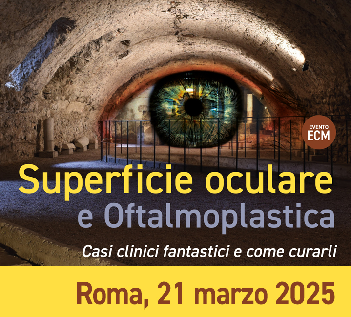 Superficie oculare e OftalmoplasticaRoma