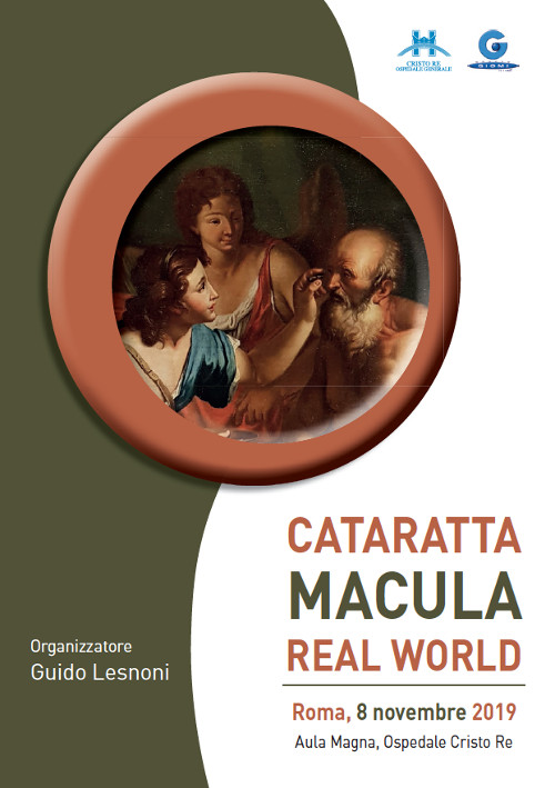 Cataratta - Macula Real World